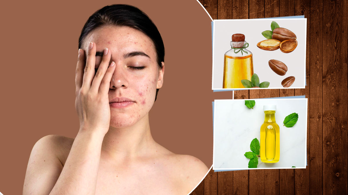 Clearing Skin Blemishes with Natural Remedies